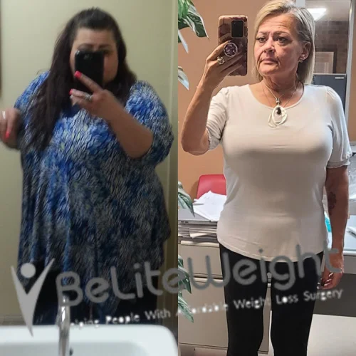 Falicity B - 1 year Update*